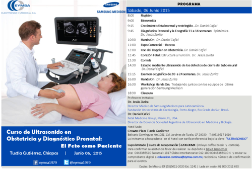 Chiapas 06 junio eymsa