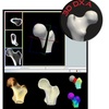 3D DXA